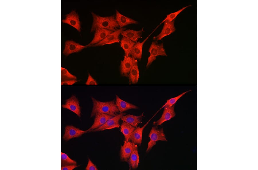 Immunofluorescence - Anti-MSRA Antibody (A9849) - Antibodies.com
