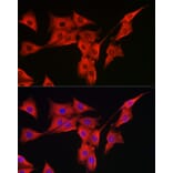 Immunofluorescence - Anti-MSRA Antibody (A9849) - Antibodies.com