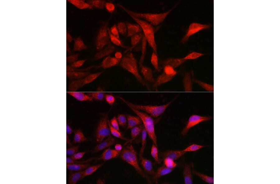 Immunofluorescence - Anti-MSRA Antibody (A9849) - Antibodies.com