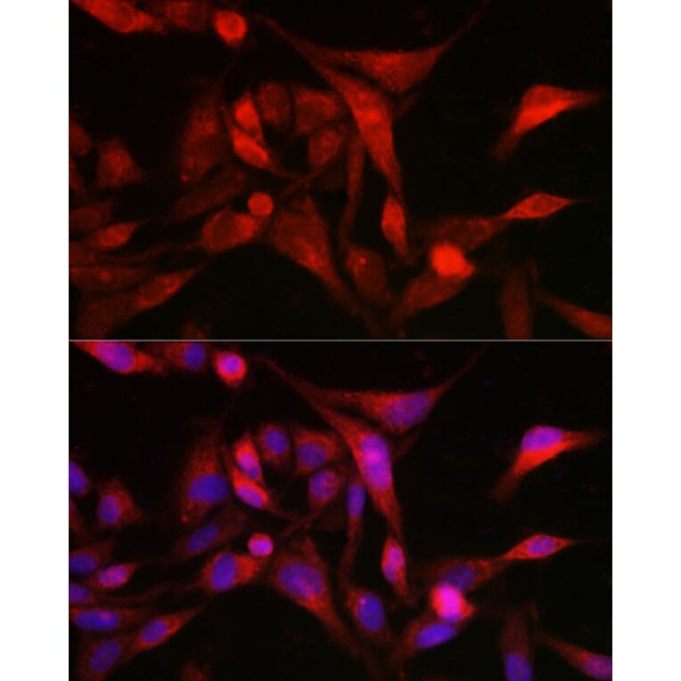 Immunofluorescence - Anti-MSRA Antibody (A9849) - Antibodies.com