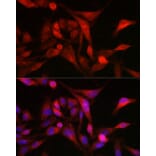 Immunofluorescence - Anti-MSRA Antibody (A9849) - Antibodies.com