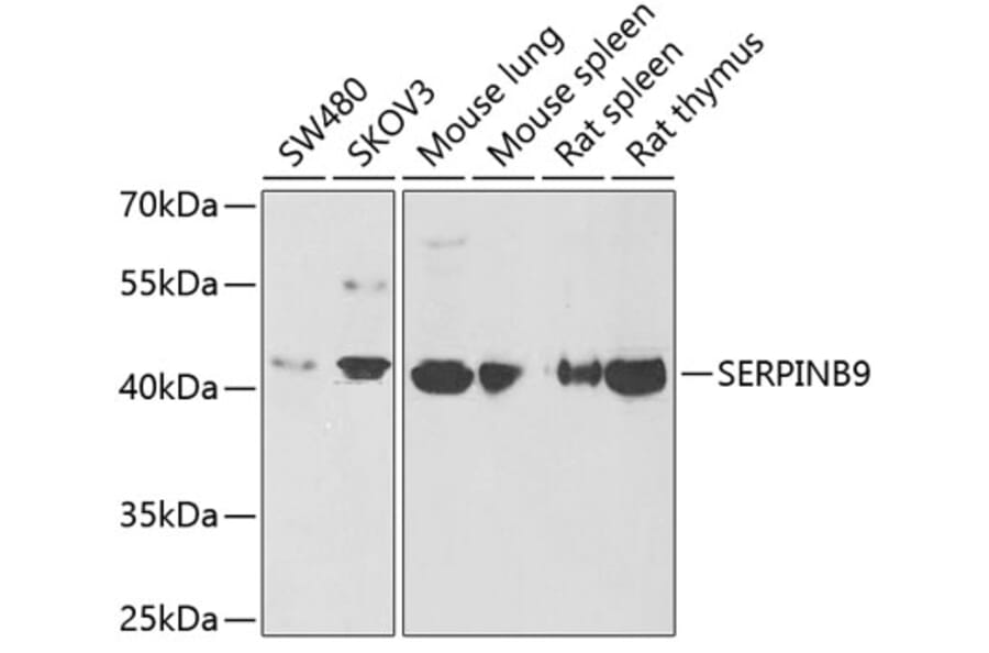 Western Blot - Anti-PI-9 Antibody (A9850) - Antibodies.com