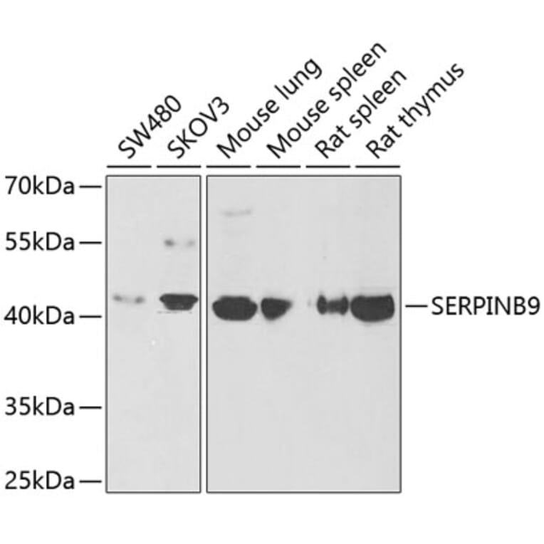 Western Blot - Anti-PI-9 Antibody (A9850) - Antibodies.com
