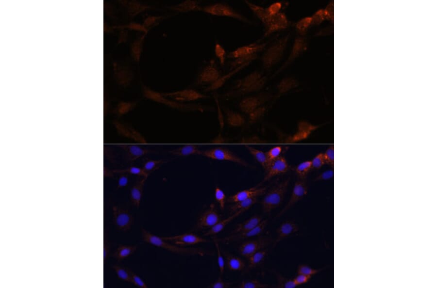 Immunofluorescence - Anti-PI-9 Antibody (A9850) - Antibodies.com