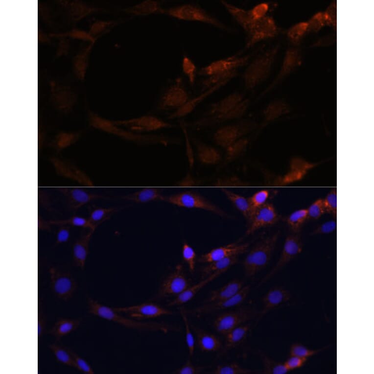Immunofluorescence - Anti-PI-9 Antibody (A9850) - Antibodies.com