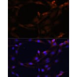 Immunofluorescence - Anti-PI-9 Antibody (A9850) - Antibodies.com