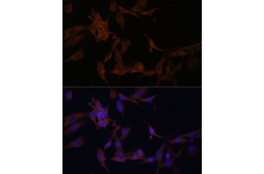Immunofluorescence - Anti-PI-9 Antibody (A9850) - Antibodies.com