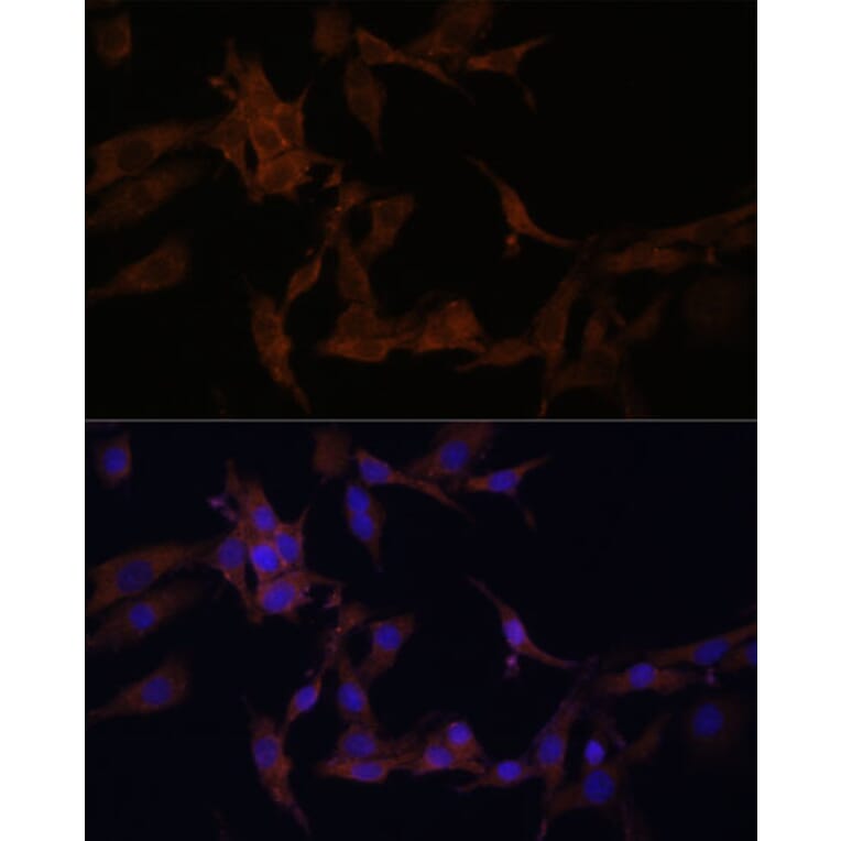 Immunofluorescence - Anti-PI-9 Antibody (A9850) - Antibodies.com