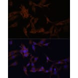 Immunofluorescence - Anti-PI-9 Antibody (A9850) - Antibodies.com