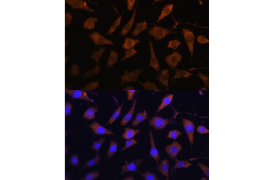 Immunofluorescence - Anti-PI-9 Antibody (A9850) - Antibodies.com