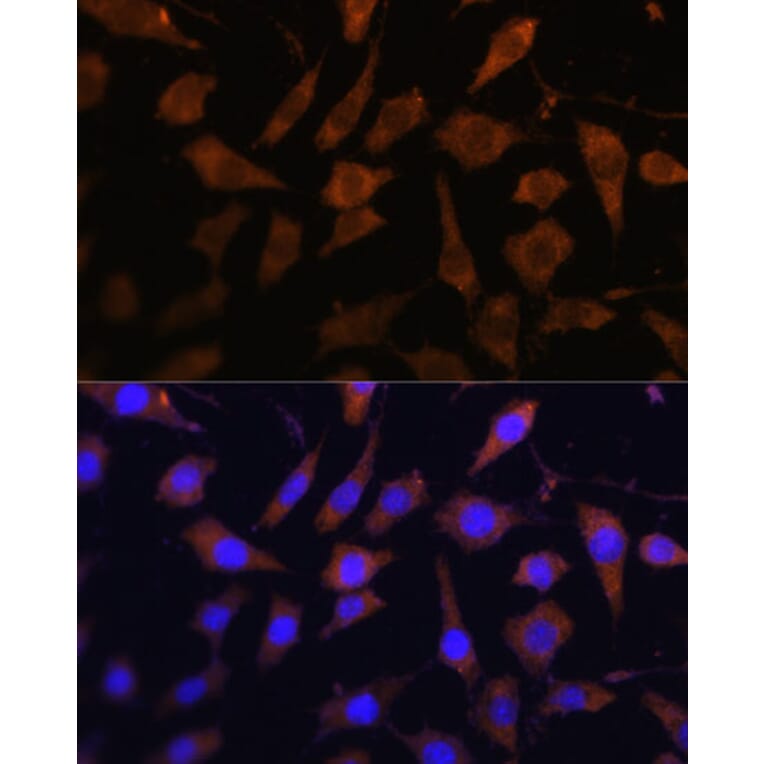 Immunofluorescence - Anti-PI-9 Antibody (A9850) - Antibodies.com