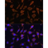 Immunofluorescence - Anti-PI-9 Antibody (A9850) - Antibodies.com