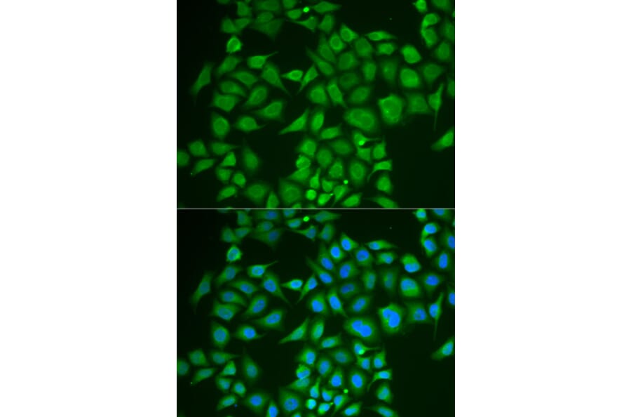 Immunofluorescence - Anti-PNOC Antibody (A6395) - Antibodies.com