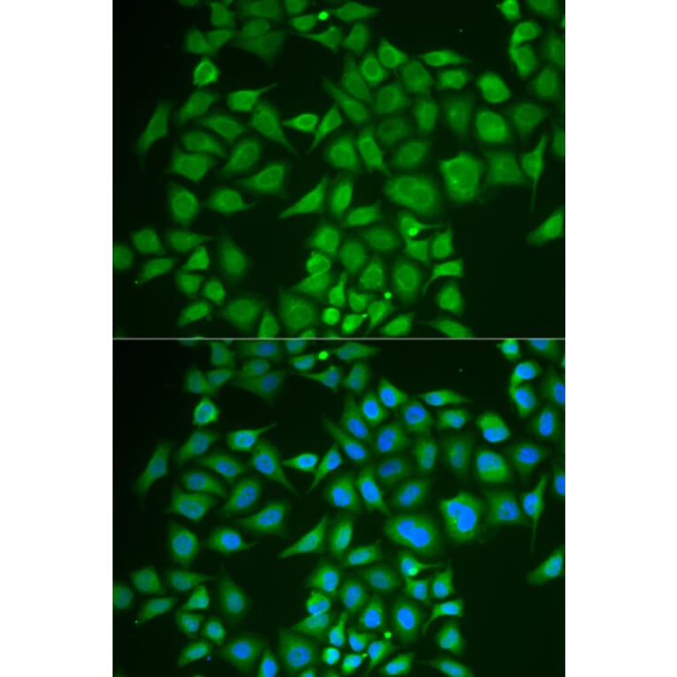 Immunofluorescence - Anti-PNOC Antibody (A6395) - Antibodies.com