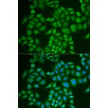 Immunofluorescence - Anti-PNOC Antibody (A6395) - Antibodies.com