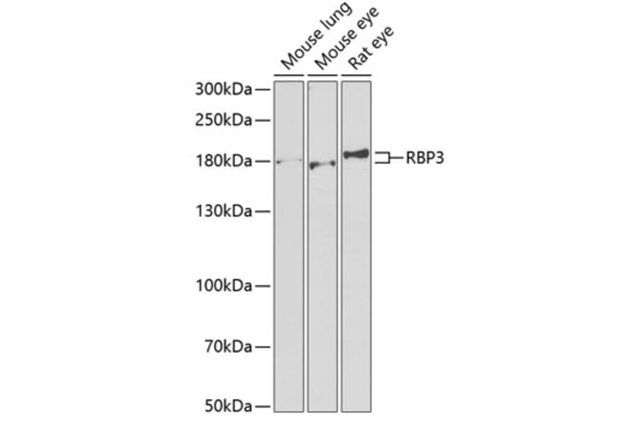Western Blot - Anti-RBP3/IRBP Antibody (A9852) - Antibodies.com
