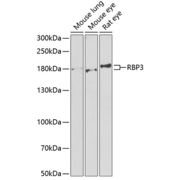 Western Blot - Anti-RBP3/IRBP Antibody (A9852) - Antibodies.com
