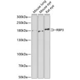 Western Blot - Anti-RBP3/IRBP Antibody (A9852) - Antibodies.com