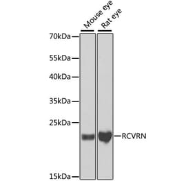 Western Blot - Anti-Recoverin Antibody (A9853) - Antibodies.com