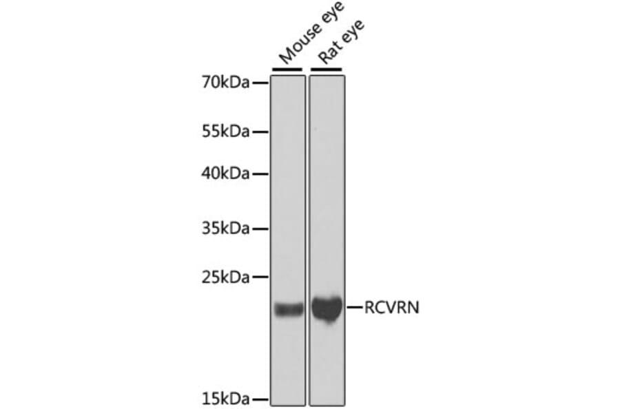 Western Blot - Anti-Recoverin Antibody (A9853) - Antibodies.com