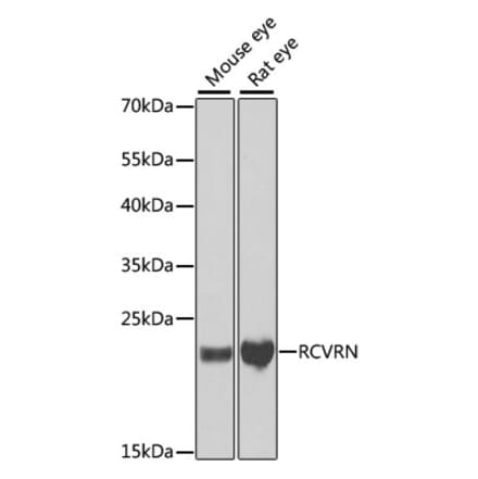 Western Blot - Anti-Recoverin Antibody (A9853) - Antibodies.com