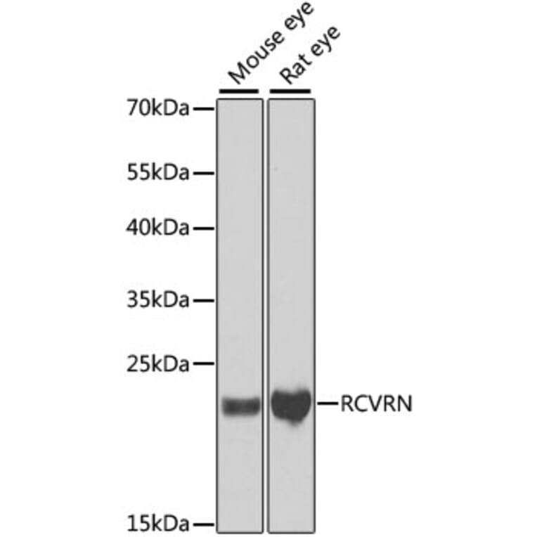 Western Blot - Anti-Recoverin Antibody (A9853) - Antibodies.com