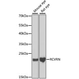 Western Blot - Anti-Recoverin Antibody (A9853) - Antibodies.com