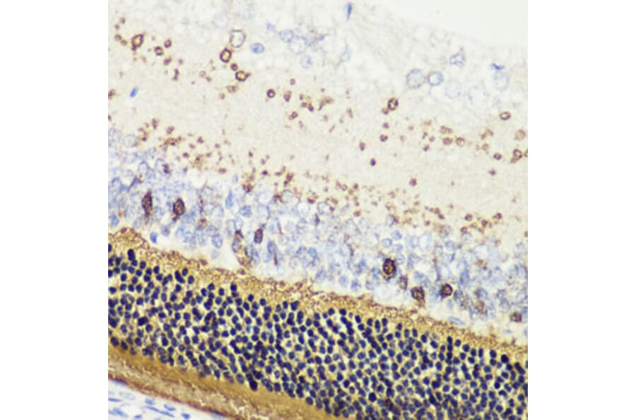 Immunohistochemistry - Anti-Recoverin Antibody (A9853) - Antibodies.com