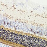 Immunohistochemistry - Anti-Recoverin Antibody (A9853) - Antibodies.com