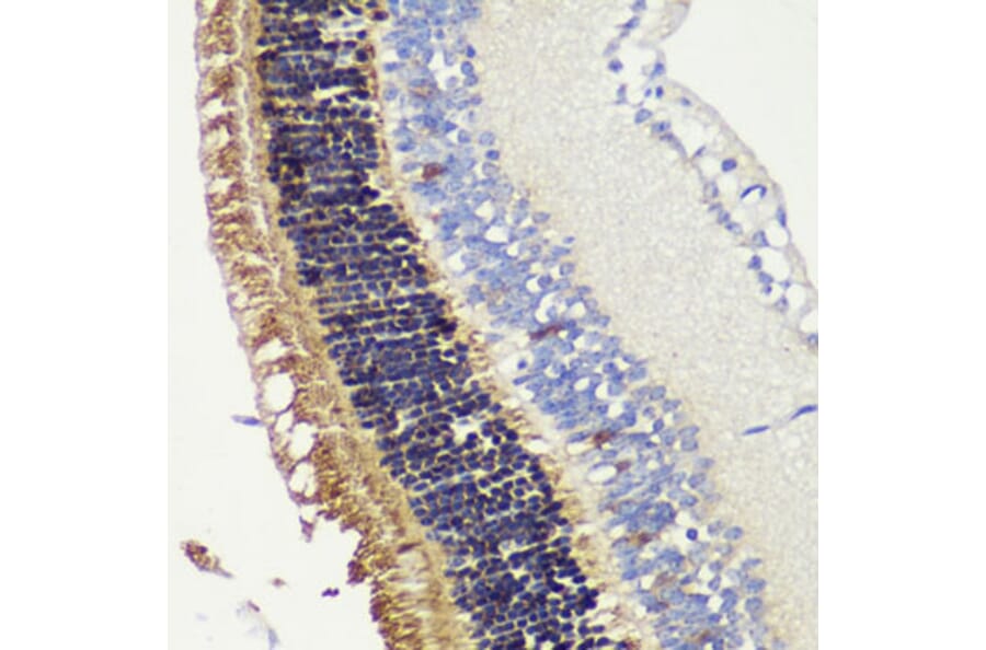 Immunohistochemistry - Anti-Recoverin Antibody (A9853) - Antibodies.com