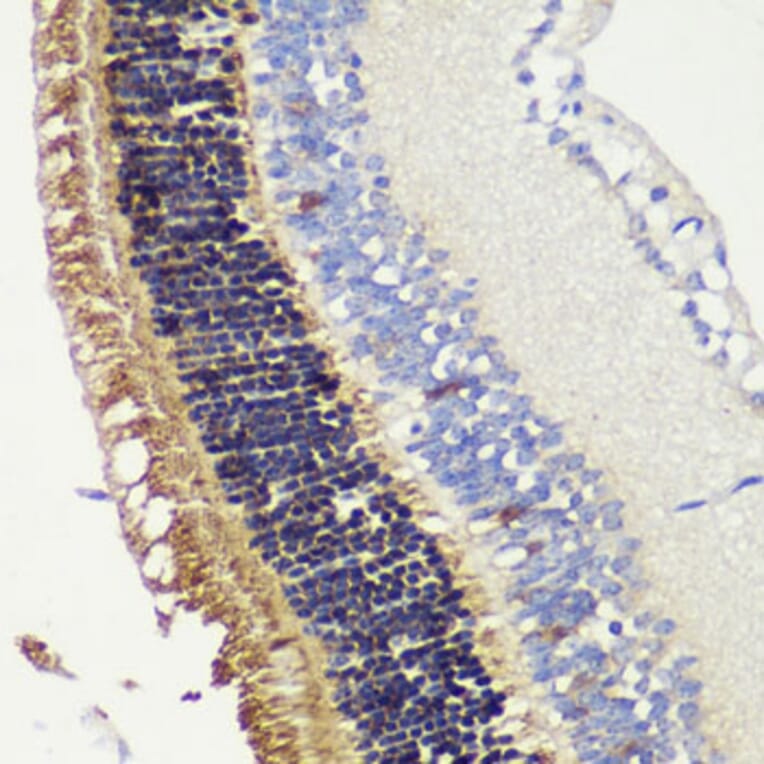 Immunohistochemistry - Anti-Recoverin Antibody (A9853) - Antibodies.com