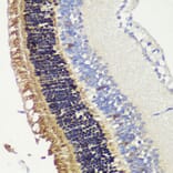 Immunohistochemistry - Anti-Recoverin Antibody (A9853) - Antibodies.com
