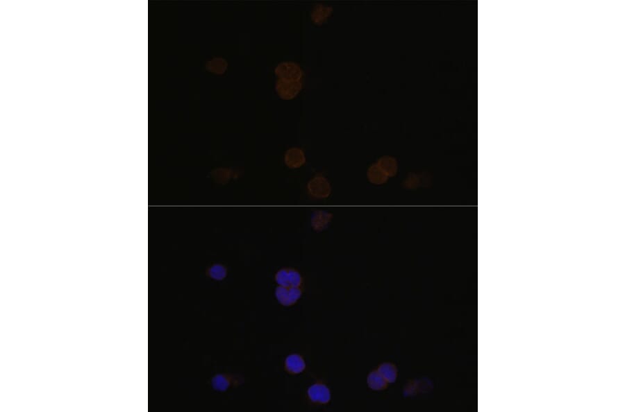 Immunofluorescence - Anti-Recoverin Antibody (A9853) - Antibodies.com