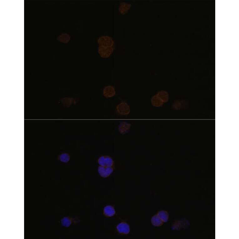 Immunofluorescence - Anti-Recoverin Antibody (A9853) - Antibodies.com