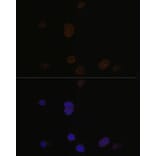 Immunofluorescence - Anti-Recoverin Antibody (A9853) - Antibodies.com