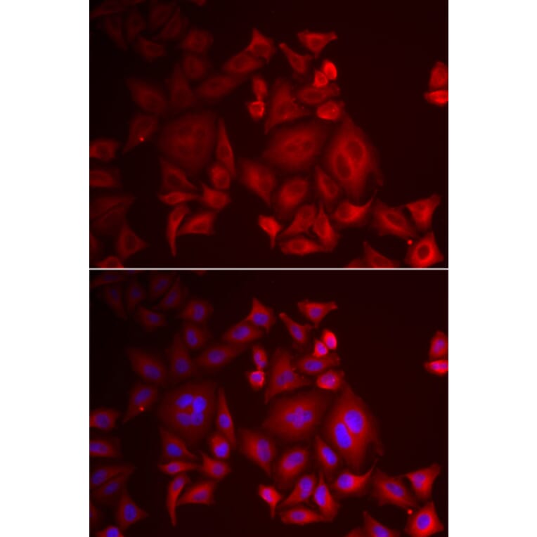 Immunofluorescence - Anti-XCL1 Antibody (A6408) - Antibodies.com