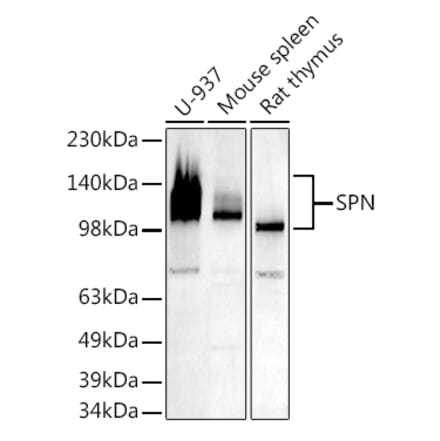 Western Blot - Anti-CD43 Antibody (A9855) - Antibodies.com