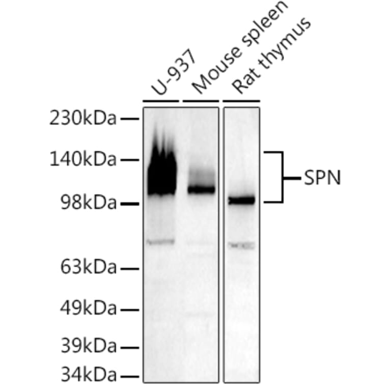 Western Blot - Anti-CD43 Antibody (A9855) - Antibodies.com