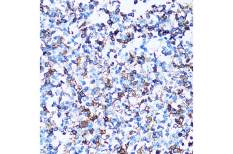 Immunohistochemistry - Anti-CD43 Antibody (A9855) - Antibodies.com