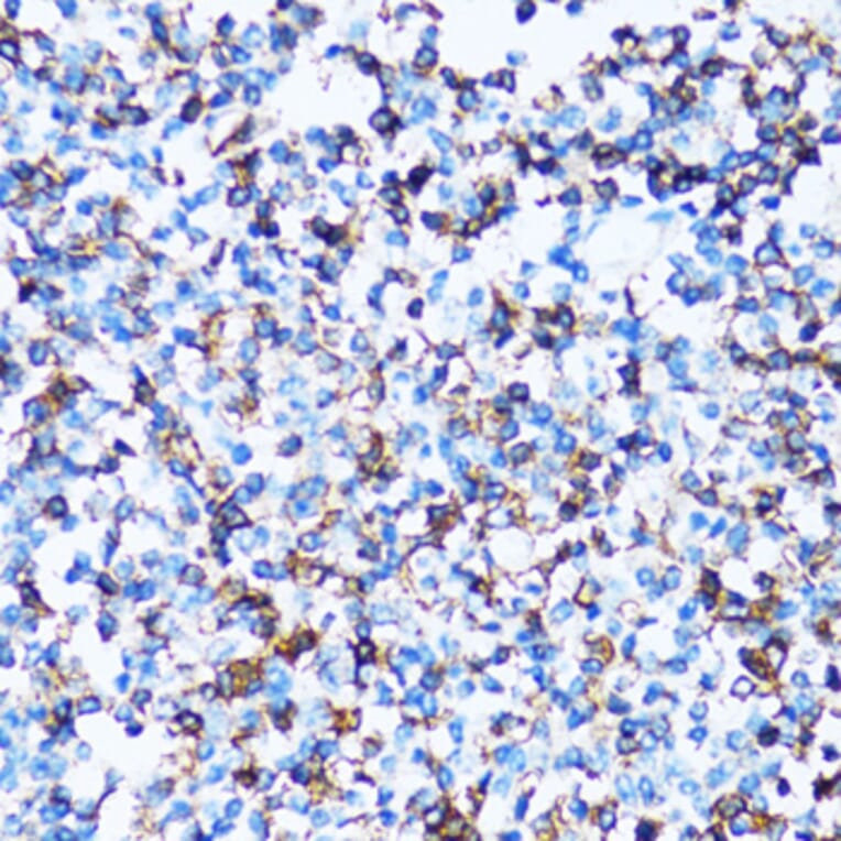 Immunohistochemistry - Anti-CD43 Antibody (A9855) - Antibodies.com