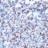 Immunohistochemistry - Anti-CD43 Antibody (A9855) - Antibodies.com