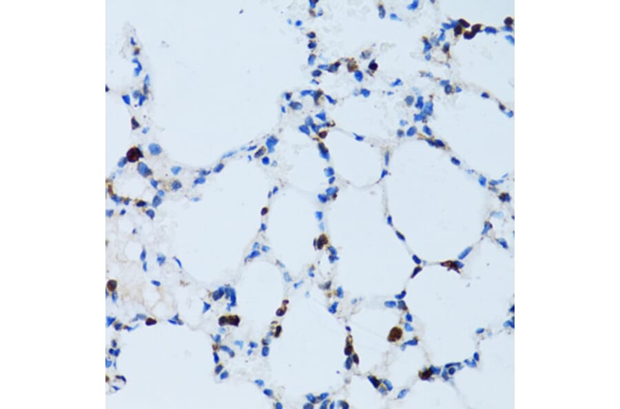 Immunohistochemistry - Anti-CD43 Antibody (A9855) - Antibodies.com