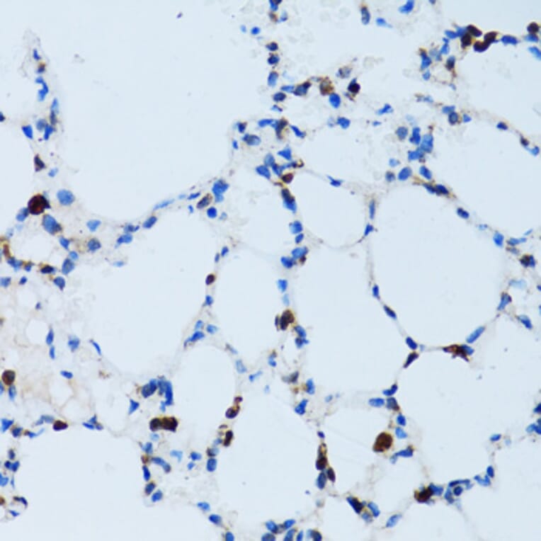 Immunohistochemistry - Anti-CD43 Antibody (A9855) - Antibodies.com