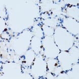 Immunohistochemistry - Anti-CD43 Antibody (A9855) - Antibodies.com