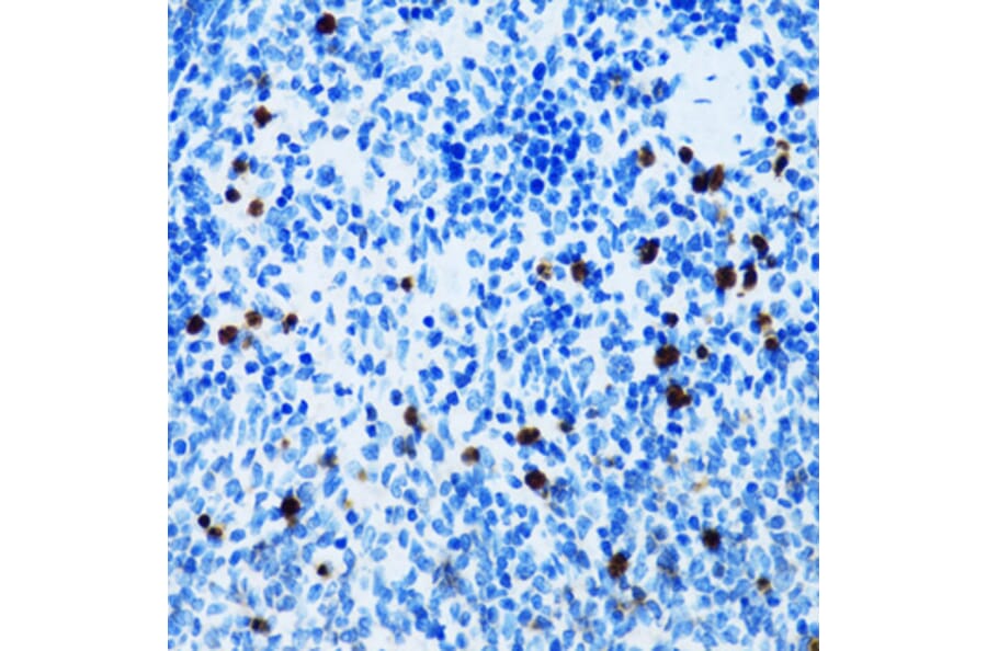 Immunohistochemistry - Anti-CD43 Antibody (A9855) - Antibodies.com
