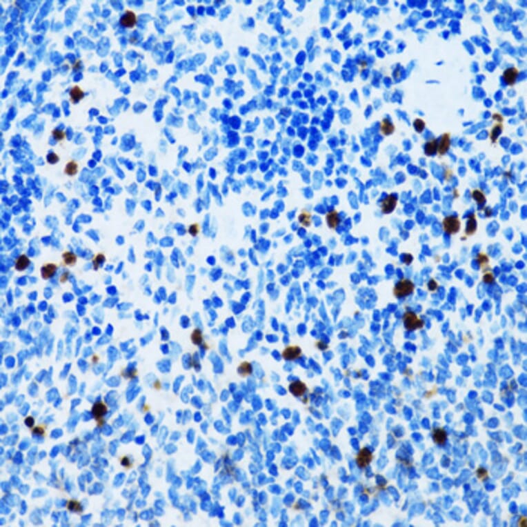 Immunohistochemistry - Anti-CD43 Antibody (A9855) - Antibodies.com