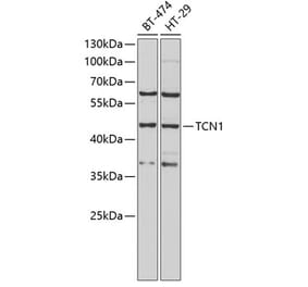 Western Blot - Anti-TCN1 Antibody (A9856) - Antibodies.com