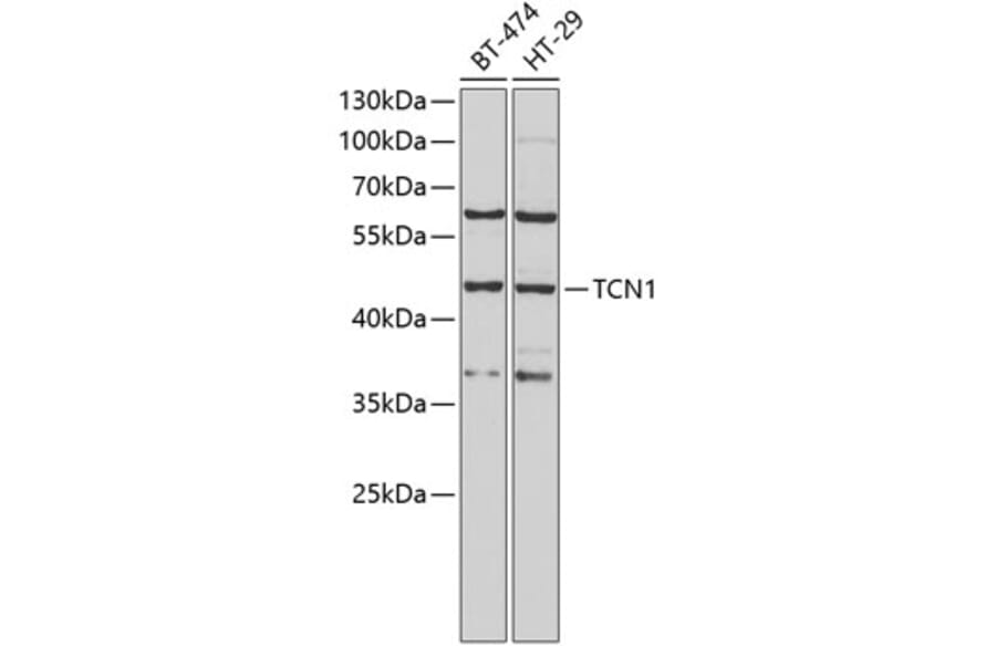 Western Blot - Anti-TCN1 Antibody (A9856) - Antibodies.com