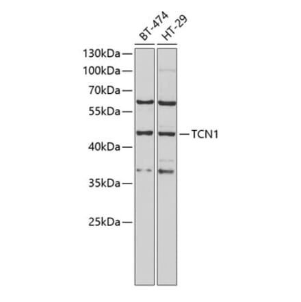 Western Blot - Anti-TCN1 Antibody (A9856) - Antibodies.com