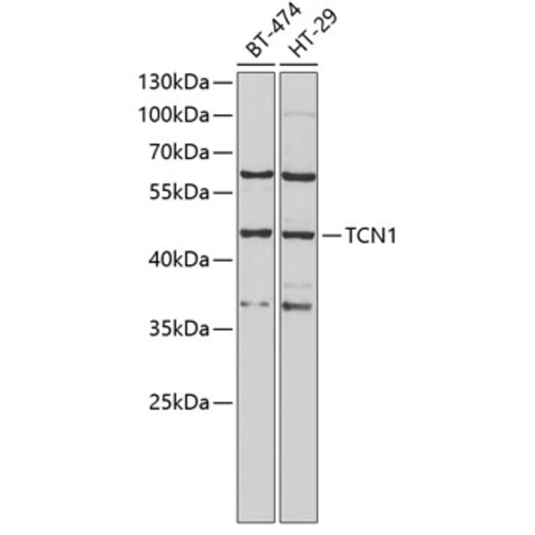 Western Blot - Anti-TCN1 Antibody (A9856) - Antibodies.com